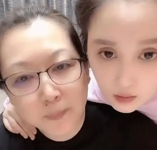 赵本山老婆谈女儿近况,球球沉迷整容已成病态,光鼻子就花了30万