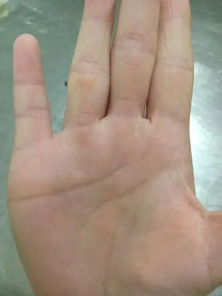 听说女人右手断掌不好是吗,看看我这个是不是断掌掌纹,求大神懂的告诉我一下