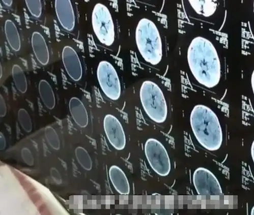 故事北京6岁女孩突发脑瘤,5天后离开人世,父母忍痛捐献女儿器官