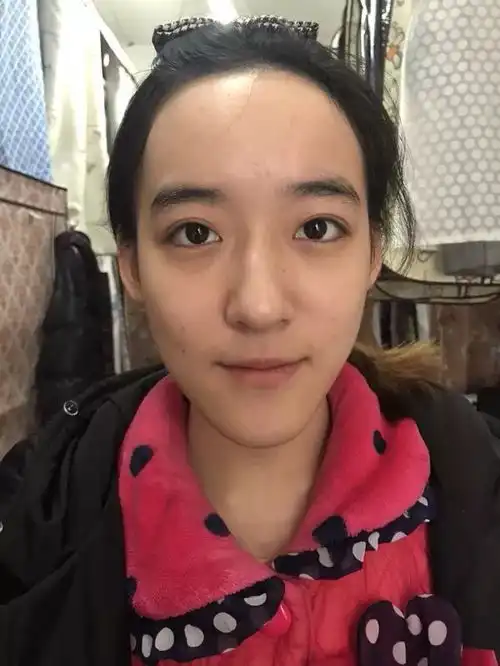 真人案例丨研究生才女的变美日记
