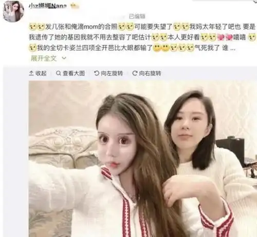 13岁女孩沉迷整容,3年间花近百万整了60次,网友不如不整