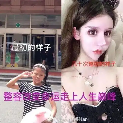 我花100万把女儿整成残废暑假扎堆整容,最小才7岁......