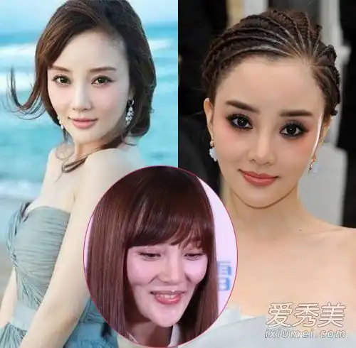 这些女演员的下巴怎么了