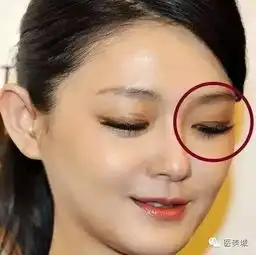 杨幂baby的双眼皮贴,我差点笑出声