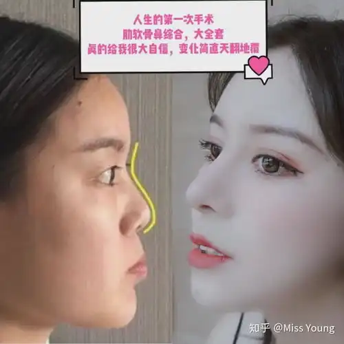 迷死氧看脸2分土妹逆袭成浓颜系大美女还撞脸了迪丽热巴