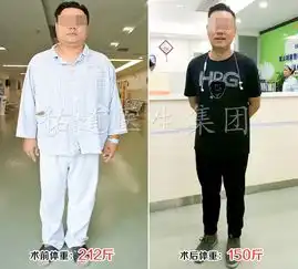 十年肥胖怎么解决缩胃手术来破解