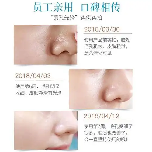 美白洗面奶去黑头男女适用祛痘印深层清洁毛孔收缩洁面乳