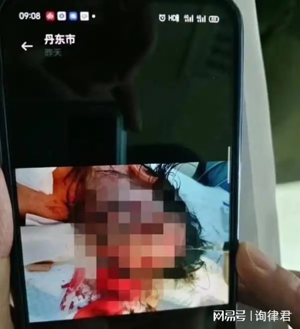 男孩用菜刀砍伤9岁女童致其缝200针,因未满14岁不负刑事责任