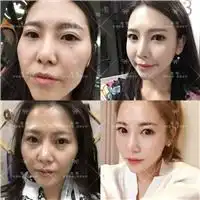 上海qq整形上海容妍整形上海沪美人ido整形医院上海qq整形