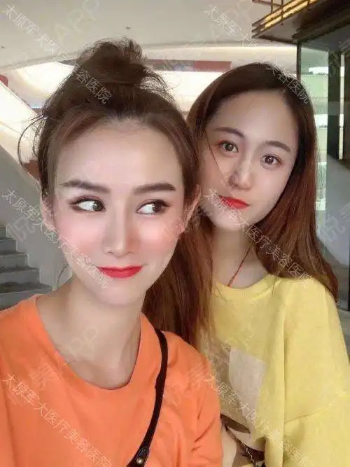 我就是你们的搞怪女孩,现在我也不说我的脸啦,大家自...形体填充悦美整形