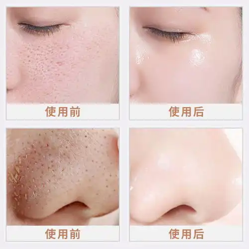 黄圣依推荐洗面奶美白学生女男收缩毛孔去黑头保湿控油洁面乳