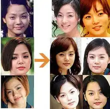 郑爽整容请郑爽看看韩国女星整容可怕后遗症