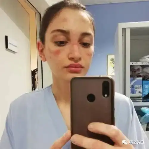 确诊超过1100,死亡21英国对大规模集会的态度可能要转180度