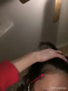 女生把头发绑起来后都会显得鬓角很少头发吗高丸子高马尾鬓角往上绑