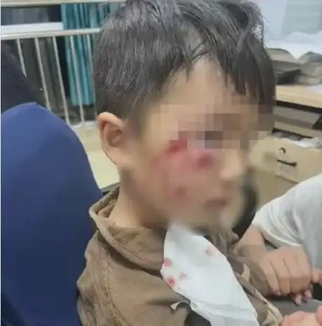 这孩子太可怜了谨记之,切切警惕狗患背后是人祸