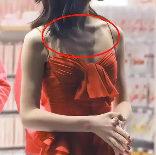 滤镜下是美女,现实中是女鬼这些瘦到病态的明星,真恐怖