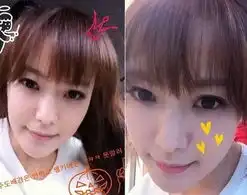 金喜善称维持美貌靠定期输血网友像吸血鬼