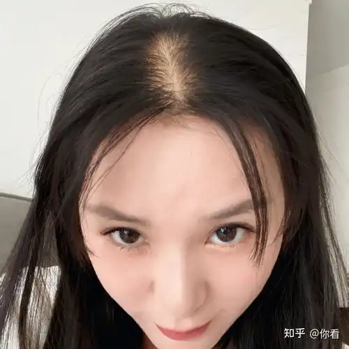 怎样改善发质和保养头发