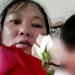 云南一女子车祸手术13年后发现右肾失踪