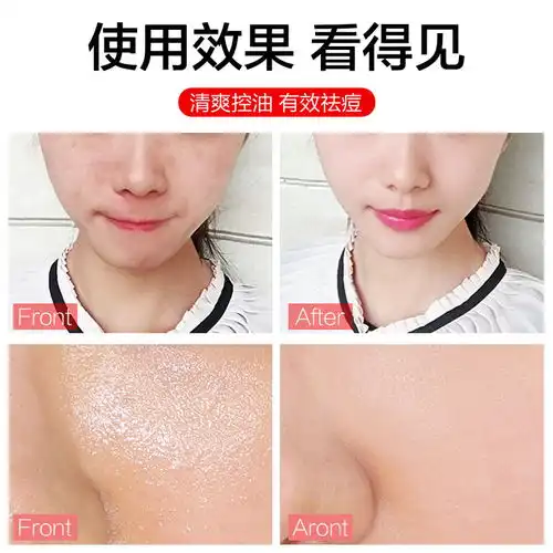 洗面奶美白补水控油祛痘去黑头深层清洁学生男女士洁面乳