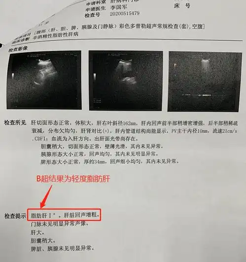 11岁娃130斤重度肝硬化,这个好习惯爸妈都要注意