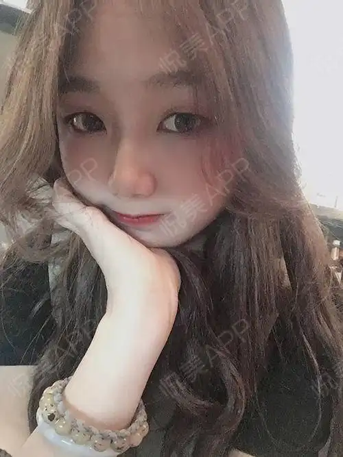 嗨喽嗨喽小美女们来更新啦,迫不及待来反馈热玛吉的皮...紧致提升悦美整形