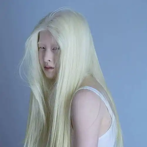 因全身雪白被遗弃的中国女孩,逆袭成超模的故事让人泪目