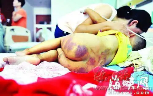 男子家暴成性将3岁儿子按进马桶扔下二楼孩子满身是伤惊恐地找妈妈组图