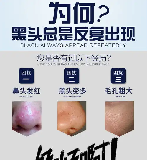 氨基酸美白洗面奶控油祛痘除螨去黑头男女学生补水保湿洁面乳