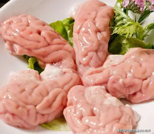 脑梗祸根已找到,医生劝告爱吃这2种食物的人,都要去检查