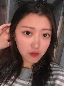 现在的我就是一个字,美美美,成功从小土妞变身大美女...垫鼻尖悦美整形