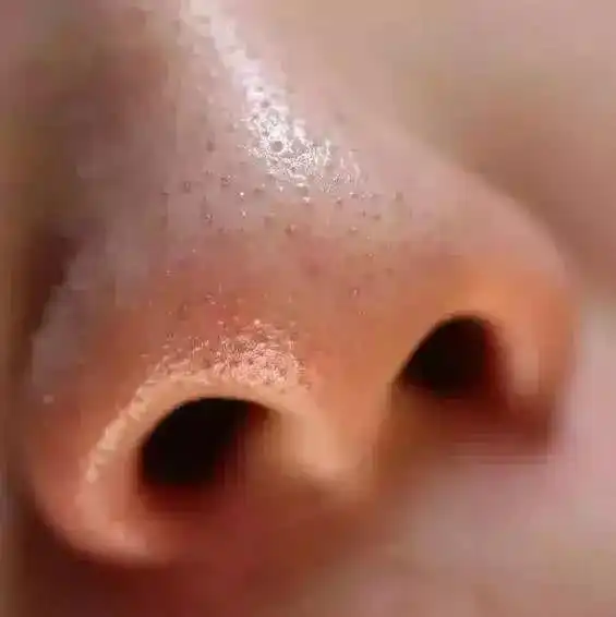 脸上斑点疯长巨丑,美籍华裔教你1个偏方,半月消斑