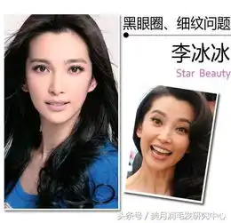 黑眼圈眼袋浮肿细纹这5种眼霜帮你全搞定
