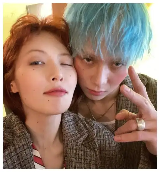 泫雅秀恩爱,和男友金晓钟穿情侣装拍合照,满脸黑痣却成了焦点
