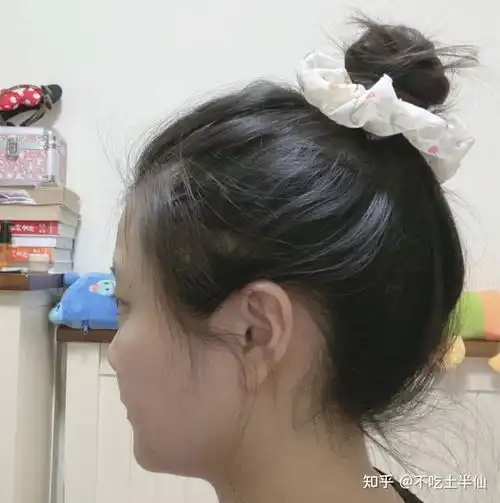 大圆脸的女生真的不适合短发吗