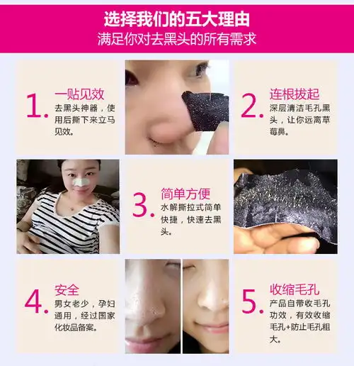 男女通用去黑头白头粉刺螨虫收缩毛孔去黑头鼻贴神器5片30片选zzh