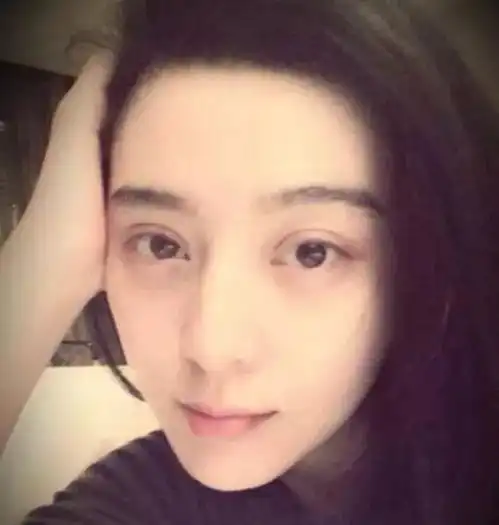 医美之都美丽援助金为什么有人越整越残如何才能避免整容变毁容