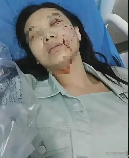 摸狗被咬女子算是万幸,狗主当接受罚款,而不是赔偿女子医药费