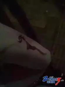 恐怖常州两女生遭到不明物体袭击鲜血直流