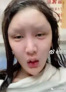 因全脸大整形而被粉丝骂的她如今恢复成这样了