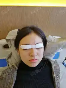我是没有毕业的大学生,可想而知,学校的美女如云呀,...眼综合悦美整形