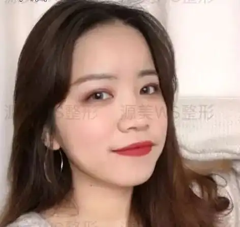 濮阳的美女千万不要去整形否则......