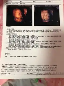 思维顺利通过已知男女接的都如愿预产期2018年06月准妈圈