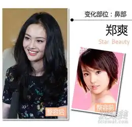 越来越美图揭郑爽到底整了哪些部位