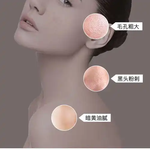 氨基酸洁面慕斯洁面乳男女士美白补水去黑头洗面奶女控油收缩毛孔