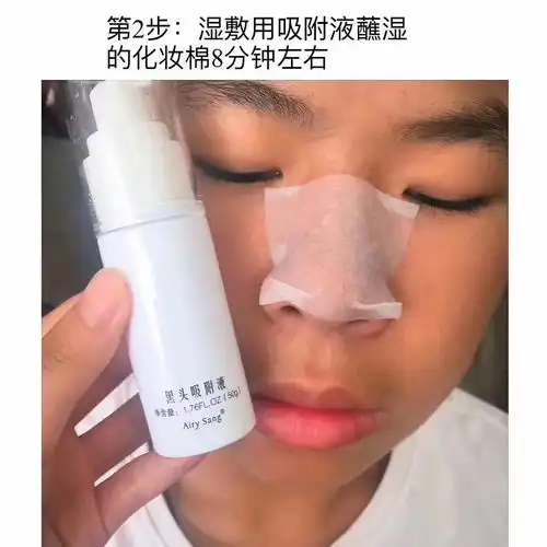 如果男友黑头严重,粉刺特别多,女友友该如何帮男友清洁皮肤...