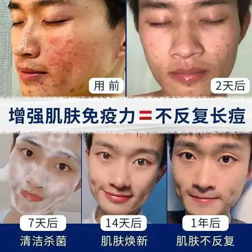 抢抢抢男士洗面奶洁面乳清爽保湿清洁毛孔控油祛痘去黑头除螨虫深层清洁