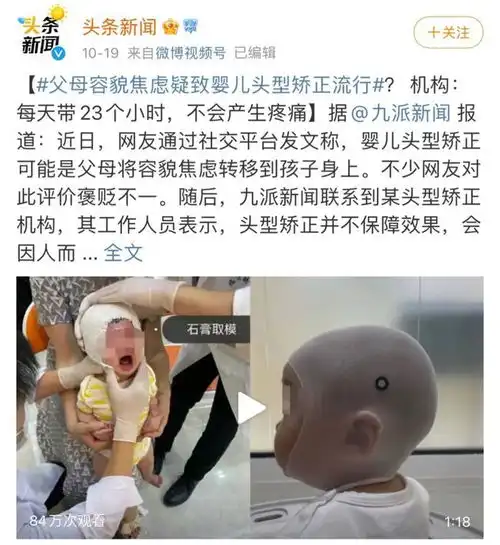 又一女子整容失败致面瘫病态审美,正在毁掉你