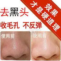 她的美丽说勋章