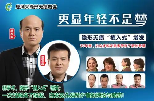 真人真发假发价格一般多少钱贵吗把假发试了一遍,告诉你哪款好
